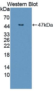 IL3 Antibody - Western blot of IL3 antibody.