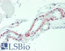 IL3 Antibody - Human Skeletal Muscle, Vessel: Formalin-Fixed, Paraffin-Embedded (FFPE)