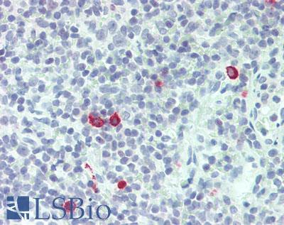 IL3 Antibody - Human Tonsil: Formalin-Fixed, Paraffin-Embedded (FFPE)