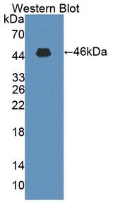 IL3 Antibody - Western Blot; Sample: Recombinant protein.