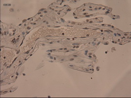 IL3 Antibody - Immunohistochemical staining of paraffin-embedded lung using anti-IL-3 mouse monoclonal antibody.