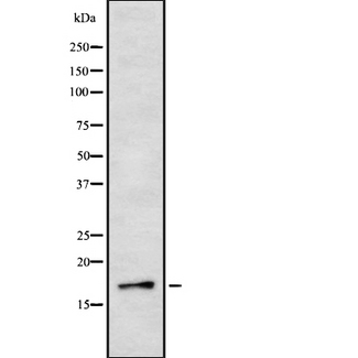 IL3 Antibody - Western blot analysis IL3 using Jurkat whole cells lysates