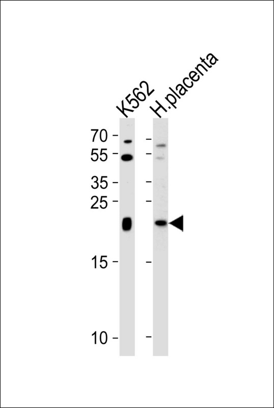 IL31 Antibody - Western blot of lysates from K562 cell line and human placenta tissue lysate (from left to right), using IL31 Antibody. Antibody was diluted at 1:1000 at each lane. A goat anti-rabbit IgG H&L (HRP) at 1:5000 dilution was used as the secondary antibody. Lysates at 35ug per lane.