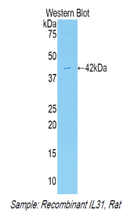 IL31 Antibody - Western blot of recombinant IL31.  This image was taken for the unconjugated form of this product. Other forms have not been tested.