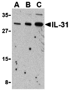 IL31 Antibody - Western blot analysis of IL-31 in RAW264.7 cell lysate with IL-31 antibody at (A) 2.5, (B) 5 and (C) 10 ug/mL.