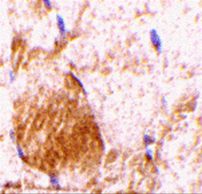 IL31 Antibody - Immunohistochemistry of IL-31 in rat skeletal muscle tissue with IL-31 antibody at 10 ug/mL.
