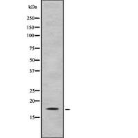 IL31 Antibody - Western blot analysis IL31 using HT29 whole cells lysates