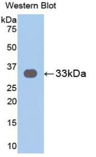 IL31RA Antibody - Western blot of recombinant IL31RA.  This image was taken for the unconjugated form of this product. Other forms have not been tested.