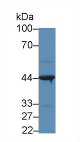 IL31RA Antibody - Western Blot; Sample: Human 293T cell lysate; Primary Ab: 5µg/ml Rabbit Anti-Human IL31RA Antibody Second Ab: 0.2µg/mL HRP-Linked Caprine Anti-Rabbit IgG Polyclonal Antibody