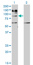 IL31RA Antibody - Western blot of IL31RA expression in transfected 293T cell line by IL31RA monoclonal antibody (M01), clone 3A10.