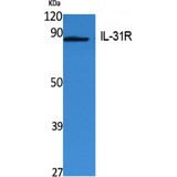IL31RA Antibody - Western blot of IL-31Ralpha antibody