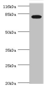 IL31RA Antibody - Western blot All Lanes:IL31RA antibody at 1.45ug/ml+Mouse kidney tissue Secondary Goat polyclonal to rabbit at 1/10000 dilution Predicted band size: 83,87,75,42,78,71,59,67,64,70,85 kDa Observed band size: 83 kDa