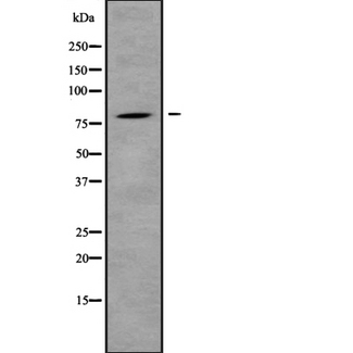 IL31RA Antibody - Western blot analysis IL31R using HepG2 whole cells lysates