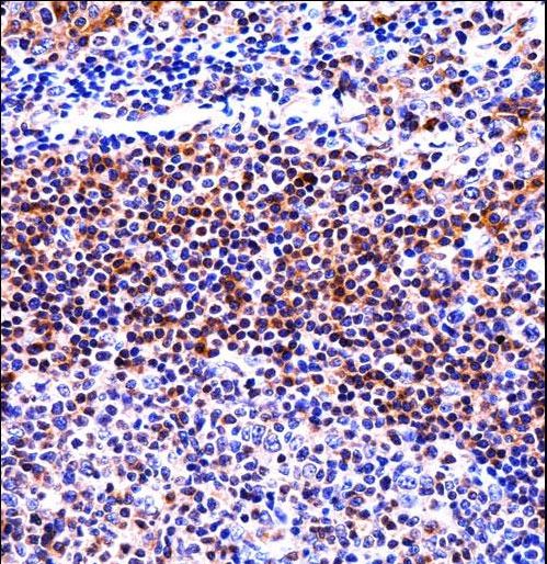 IL32 Antibody - IL32 Antibody immunohistochemistry of formalin-fixed and paraffin-embedded human tonsil tissue followed by peroxidase-conjugated secondary antibody and DAB staining.