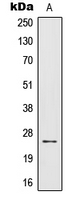 IL32 Antibody - Western blot analysis of IL-32 expression in Jurkat (A) whole cell lysates.