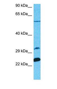 IL32 Antibody - Western blot of IL32 Antibody with human Jurkat Whole Cell lysate.  This image was taken for the unconjugated form of this product. Other forms have not been tested.