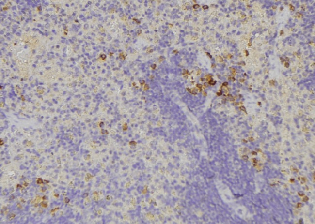 IL32 Antibody - 1:100 staining human lymph node tissue by IHC-P. The sample was formaldehyde fixed and a heat mediated antigen retrieval step in citrate buffer was performed. The sample was then blocked and incubated with the antibody for 1.5 hours at 22°C. An HRP conjugated goat anti-rabbit antibody was used as the secondary.