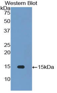 IL34 Antibody - Western blot of recombinant IL34.  This image was taken for the unconjugated form of this product. Other forms have not been tested.
