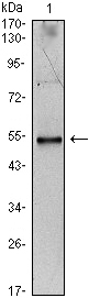 IL34 Antibody - Western blot using IL34 monoclonal antibody against IL34-hIgGFc transfected HEK293 cell lysate.
