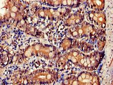 IL34 Antibody - Immunohistochemistry of paraffin-embedded human small intestine tissue at dilution of 1:100