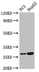 IL34 Antibody - Western Blot Positive WB detected in:PC3 whole cell lysate,HepG2 whole cell lysate All Lanes:IL34 antibody at 4µg/ml Secondary Goat polyclonal to rabbit IgG at 1/50000 dilution Predicted band size: 28 KDa Observed band size: 28 KDa