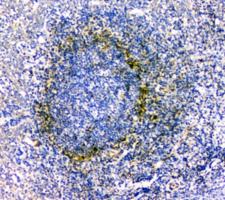 IL34 Antibody - IHC staining of FFPE human tonsil tissue with IL-34 antibody at 1ug/ml. HIER: boil tissue sections in pH6, 10mM citrate buffer, for 10-20 min and allow to cool before testing.