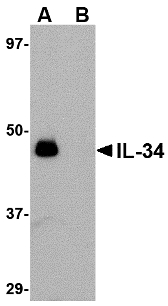 IL34 Antibody - Western blot of IL-34 in human brain tissue lysate with IL-34 antibody at 0.25 ug/ml in (A) the absence and (B) the presence of blocking peptide.