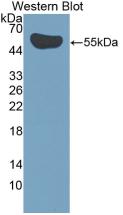 IL35 Antibody