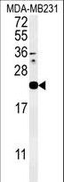 IL36A Antibody - Western blot of IL1F6 Antibody in MDA-MB231 cell line lysates (35 ug/lane). IL1F6 (arrow) was detected using the purified antibody.