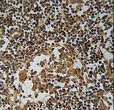IL36A Antibody - IL1F6 Antibody immunohistochemistry of formalin-fixed and paraffin-embedded human lymph tissue followed by peroxidase-conjugated secondary antibody and DAB staining.