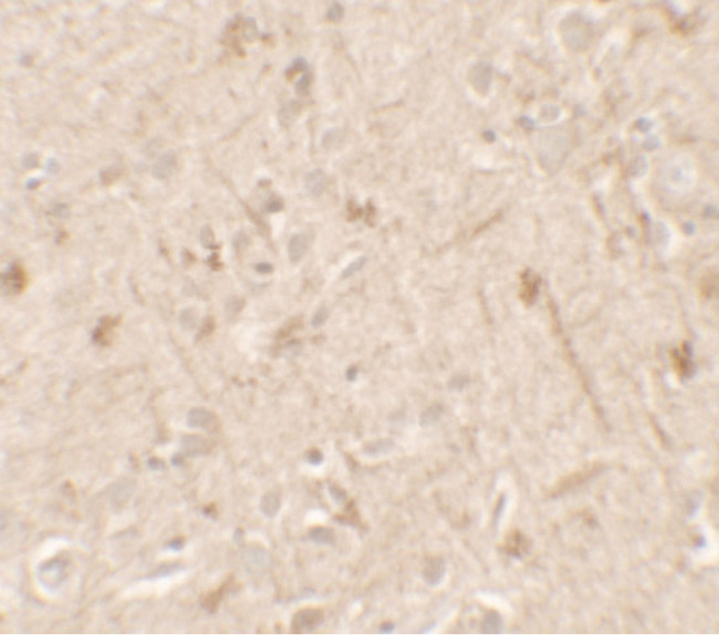 IL36A Antibody - Immunohistochemistry of IL-36A in human brain tissue with IL-36A antibody at 5 ug/ml.