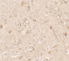 IL36A Antibody - Immunohistochemistry of IL-36A in human brain tissue with IL-36A antibody at 5 ug/ml.