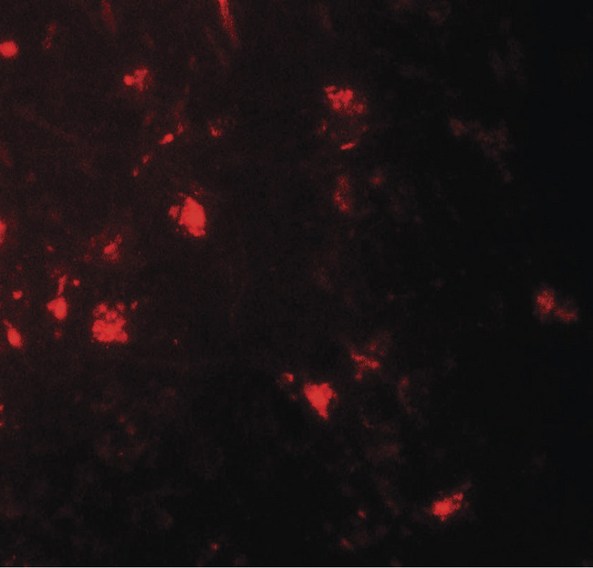 IL36A Antibody - Immunofluorescence of IL-36A in human brain tissue with IL-36A antibody at 20 ug/ml.