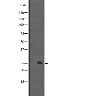 IL36A Antibody - Western blot analysis of IL1F6 expression in HEK293 cells. The lane on the left is treated with the antigen-specific peptide.