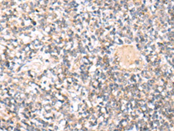 IL36A Antibody - Immunohistochemistry of paraffin-embedded Human tonsil tissue  using IL36A Polyclonal Antibody at dilution of 1:30(×200)