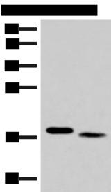IL36A Antibody - Western blot analysis of Mouse liver tissue and Human tonsil tissue lysates  using IL36A Polyclonal Antibody at dilution of 1:300