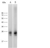 IL36B Antibody - Anti-IL1F8 rabbit monoclonal antibody at 1:500 dilution. Lane A: Mouse liver tissue lysate. Lane B: Mouse kidney tissue lysate. Lysates/proteins at 30 ug per lane. Secondary: Goat Anti-Rabbit IgG (H+L)/HRP at 1/10000 dilution. Developed using the ECL technique. Performed under reducing conditions. Predicted band size: 21 kDa. Observed band size: 25 kDa.