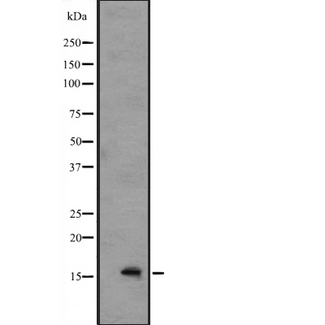 IL36B Antibody - Western blot analysis of IL1F8 expression in A549 cell lysates with blocking peptide. The lane on the left is treated with the antigen-specific peptide.