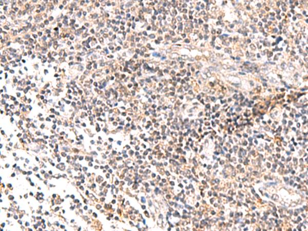 IL36B Antibody - Immunohistochemistry of paraffin-embedded Human tonsil tissue  using IL36B Polyclonal Antibody at dilution of 1:40(×200)