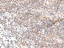 IL36B Antibody - Immunohistochemistry of paraffin-embedded Human tonsil tissue  using IL36B Polyclonal Antibody at dilution of 1:40(×200)