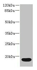 IL36RN / IL1F5 Antibody - Western blot All lanes: IL36RN antibody at 16µg/ml + Mouse stomach tissue Secondary Goat polyclonal to rabbit IgG at 1/10000 dilution Predicted band size: 17 kDa Observed band size: 17 kDa