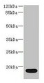 IL36RN / IL1F5 Antibody - Western blot All lanes: IL36RN antibody at 16µg/ml + Mouse stomach tissue Secondary Goat polyclonal to rabbit IgG at 1/10000 dilution Predicted band size: 17 kDa Observed band size: 17 kDa