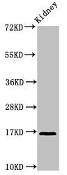 IL36RN / IL1F5 Antibody - Western Blot Positive WB detected in: Rat kidney tissue All lanes: IL36RN antibody at 3.2µg/ml Secondary Goat polyclonal to rabbit IgG at 1/50000 dilution Predicted band size: 17 kDa Observed band size: 17 kDa