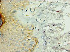 IL36RN / IL1F5 Antibody - Immunohistochemistry of paraffin-embedded human skin tissue using antibody at 1:100 dilution.
