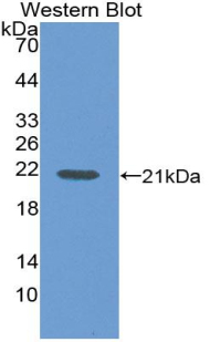 IL36RN / IL1F5 Antibody - Western blot of recombinant IL36RN / IL1F5.