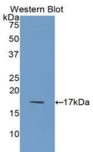 IL36RN / IL1F5 Antibody - Western blot of recombinant IL1F5.  This image was taken for the unconjugated form of this product. Other forms have not been tested.