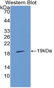 IL36RN / IL1F5 Antibody - Western blot of recombinant IL36RN / IL1F5.