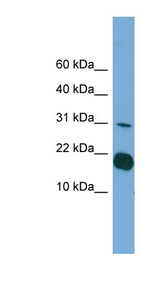 IL36RN / IL1F5 Antibody - IL1F5 antibody Western blot of Transfected 293T cell lysate. This image was taken for the unconjugated form of this product. Other forms have not been tested.