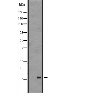 IL36RN / IL1F5 Antibody - Western blot analysis of IL1F5 expression in Transfected 293T cells lysate. The lane on the left is treated with the antigen-specific peptide.