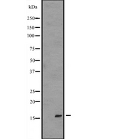 IL36RN / IL1F5 Antibody - Western blot analysis of IL1F5 expression in Transfected 293T cells lysate. The lane on the left is treated with the antigen-specific peptide.